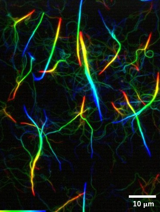 図2 経時的に色分けした蛍光アクチンフィラメントの束化過程のTIRF像